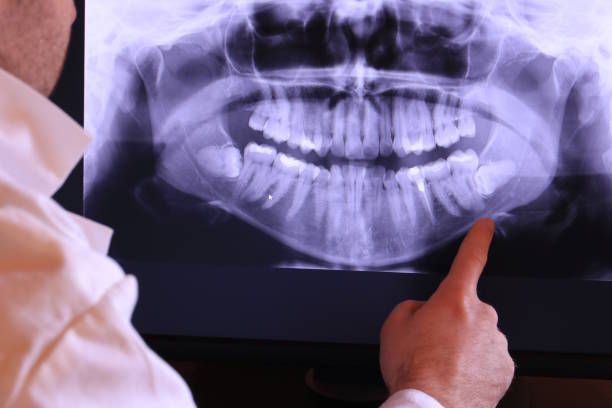 Best After-Hours Emergency Dentist in Spring Valley, NV